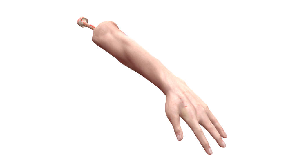 Severed Arm